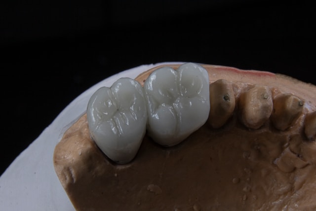 Implantes dentales de zirconio vs titanio: ¿cuál elegir?