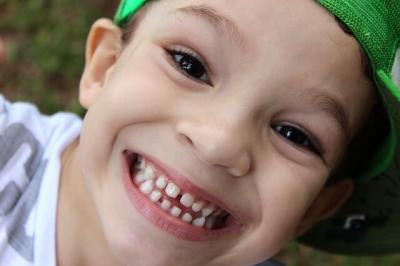 Cuidados en la salud dental de los niños