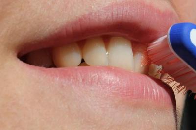Consejos para cuidar tus dientes después de un blanqueamiento